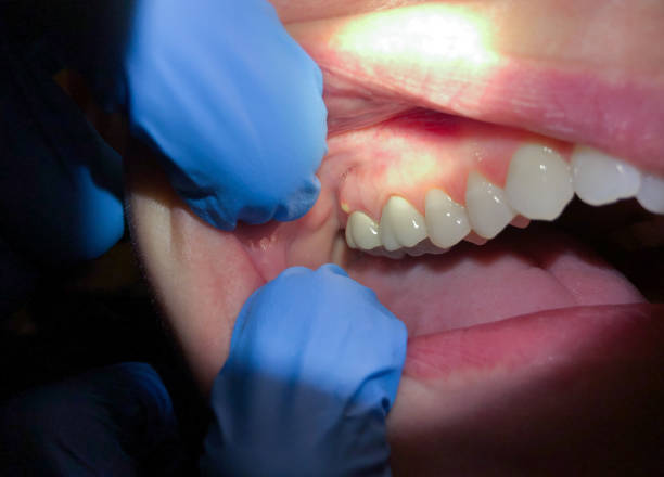 Best Tooth Pain Emergency Relief  in Olivette, MO